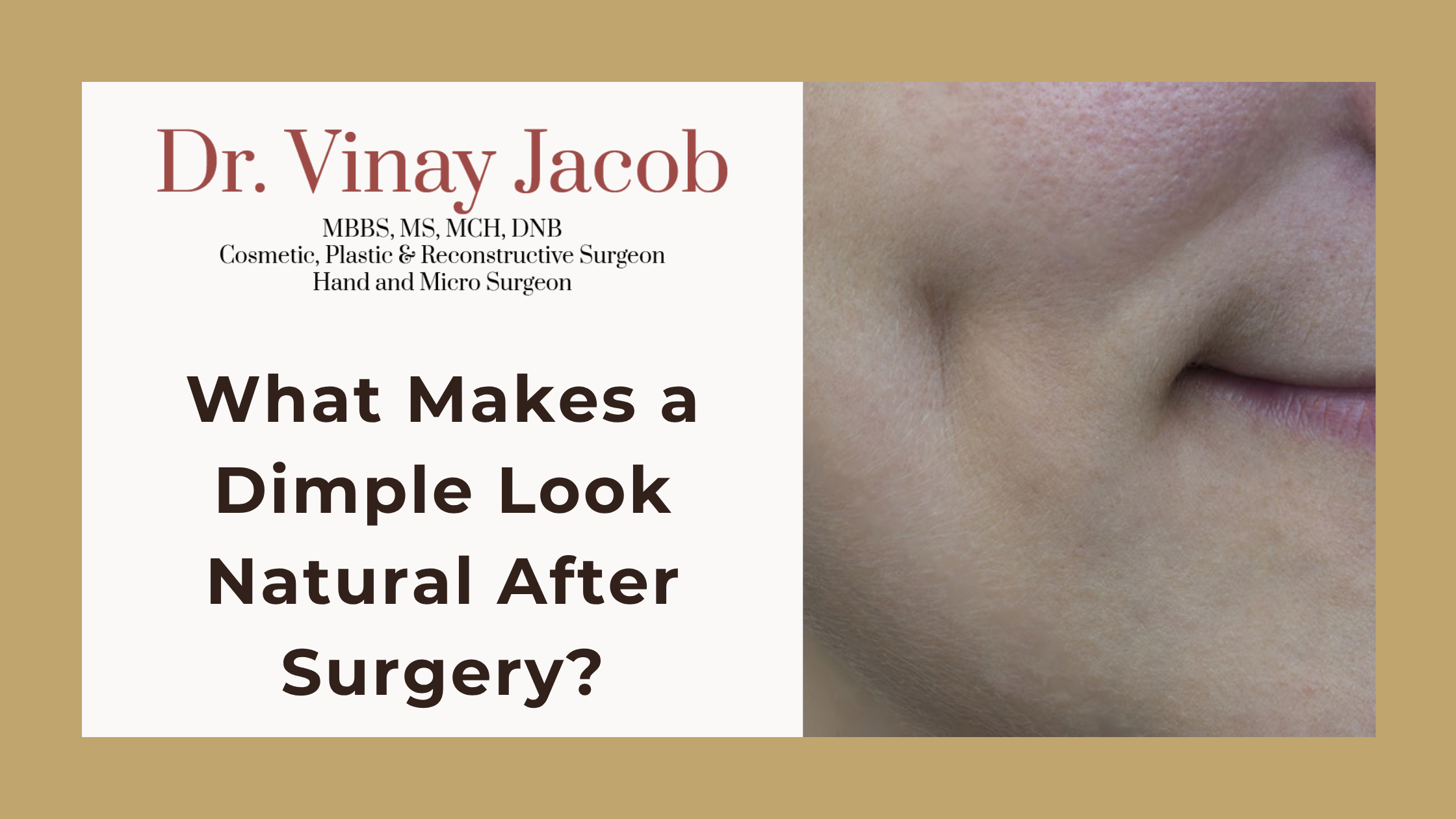 What Makes a Dimple Look Natural After Surgery?