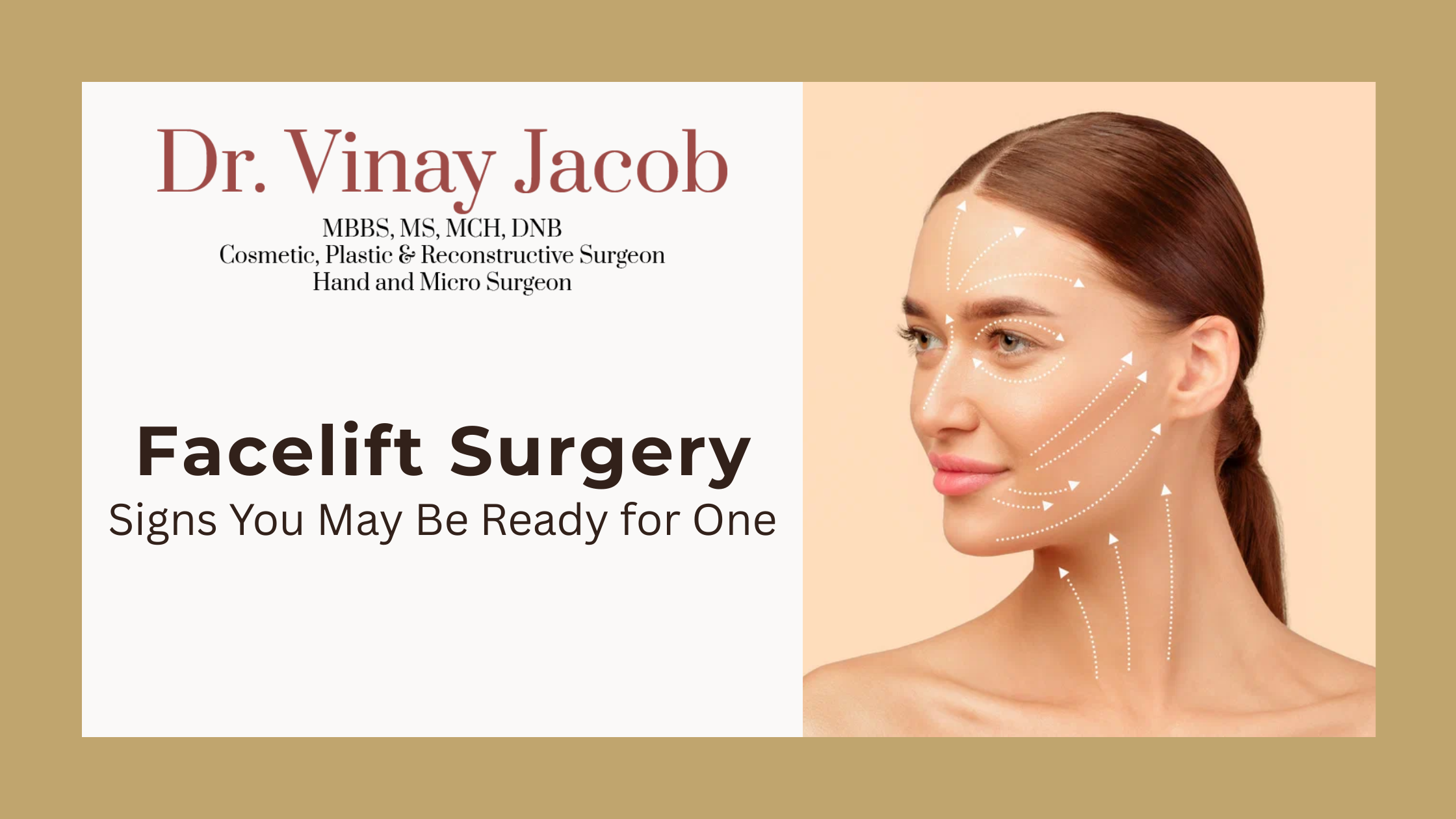 Facelift Surgery in Mumbai: Signs You May Be Ready for One