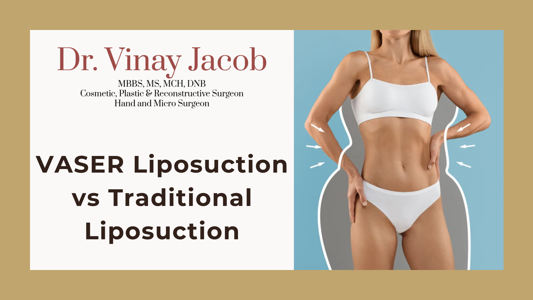 VASER Liposuction vs Traditional Liposuction: Which Is Better?