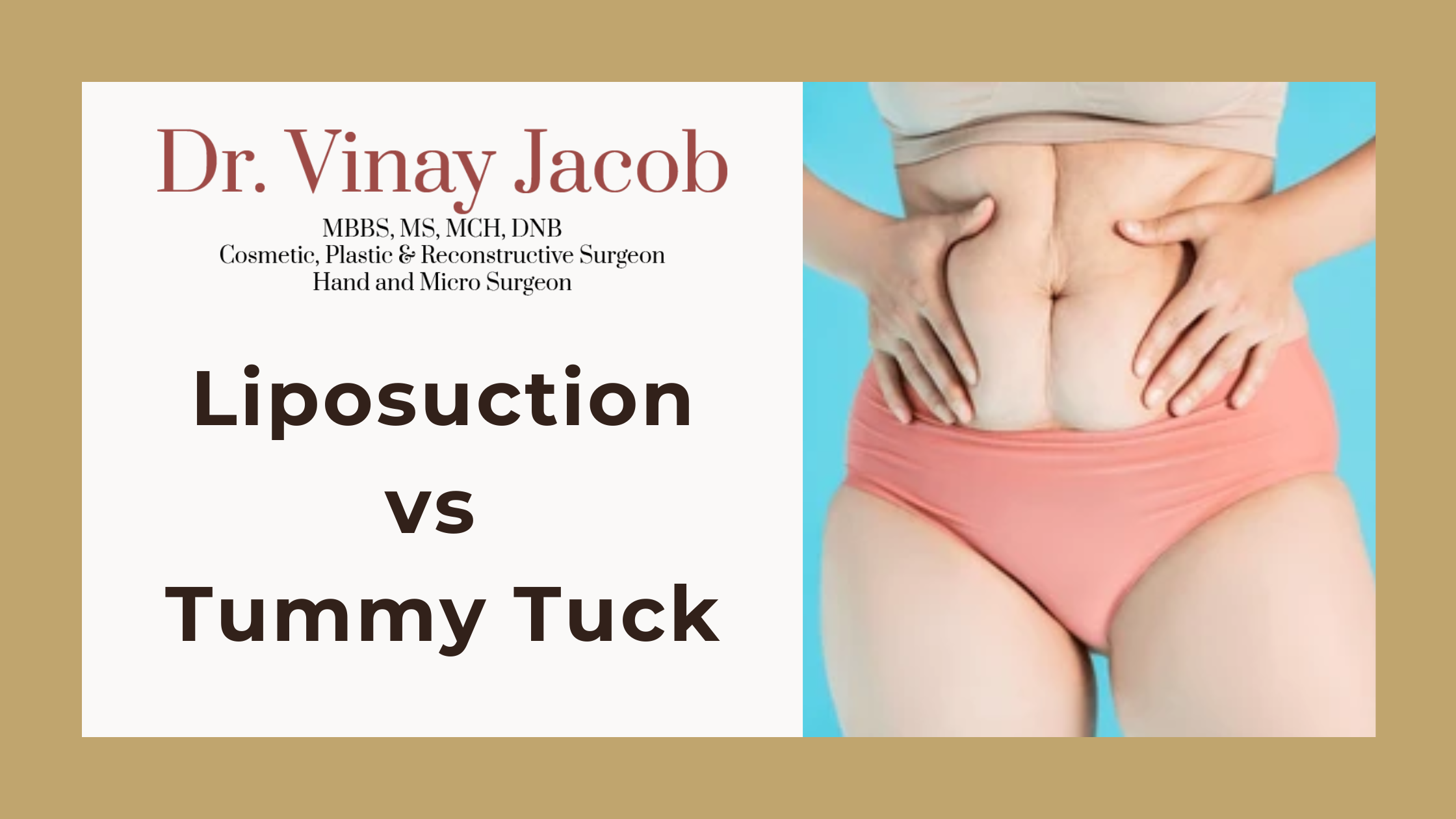 Liposuction vs Tummy Tuck: Which Is Better for You?