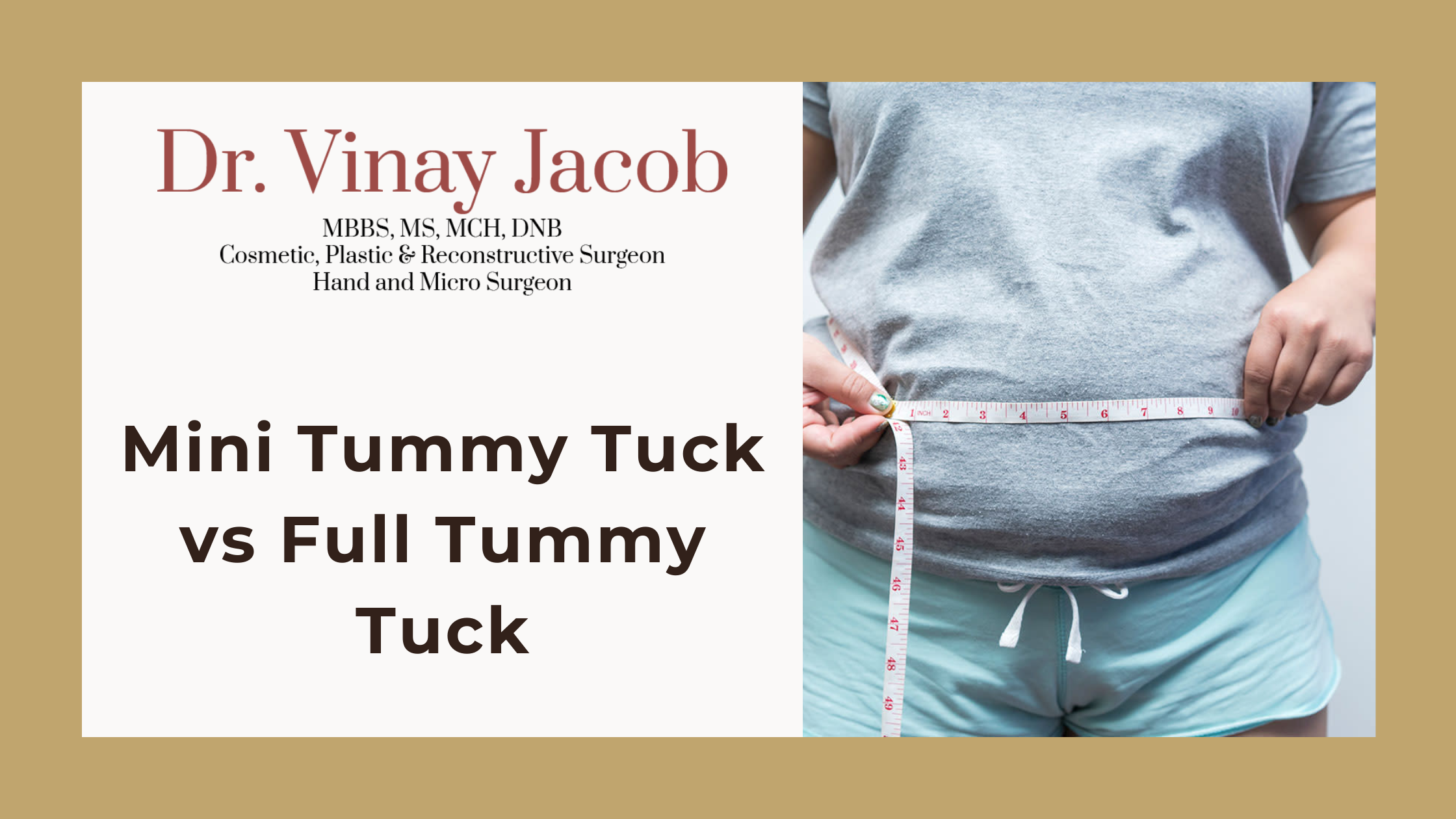 Mini Tummy Tuck vs Full Tummy Tuck: What's the Difference?