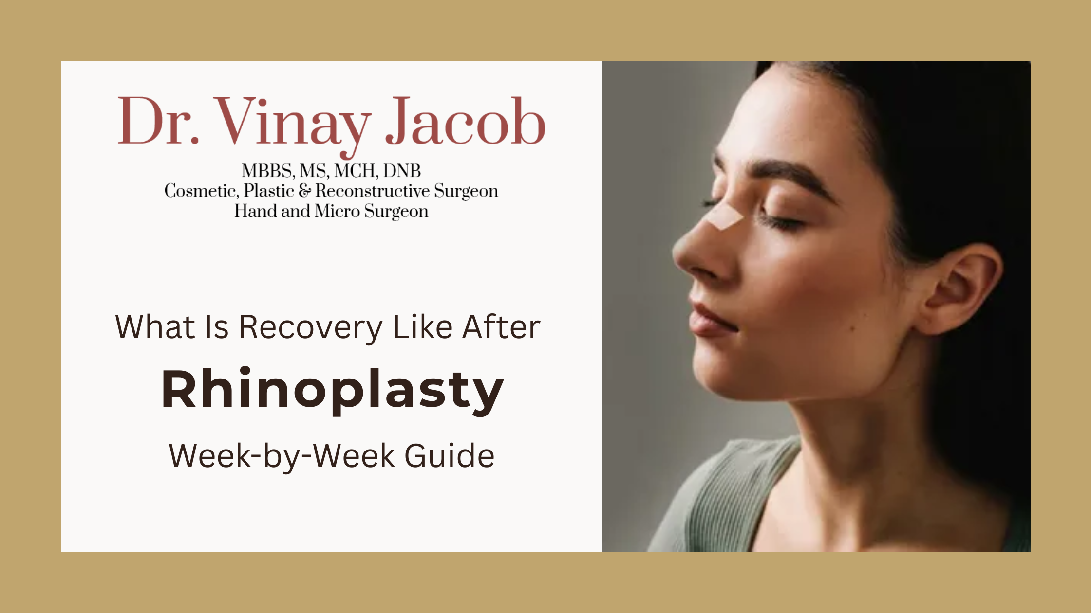 What Is Recovery Like After Rhinoplasty? Week-by-Week Guide