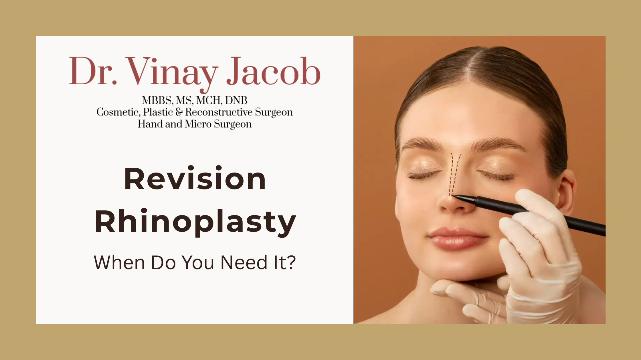 Revision Rhinoplasty: When Do You Need It?