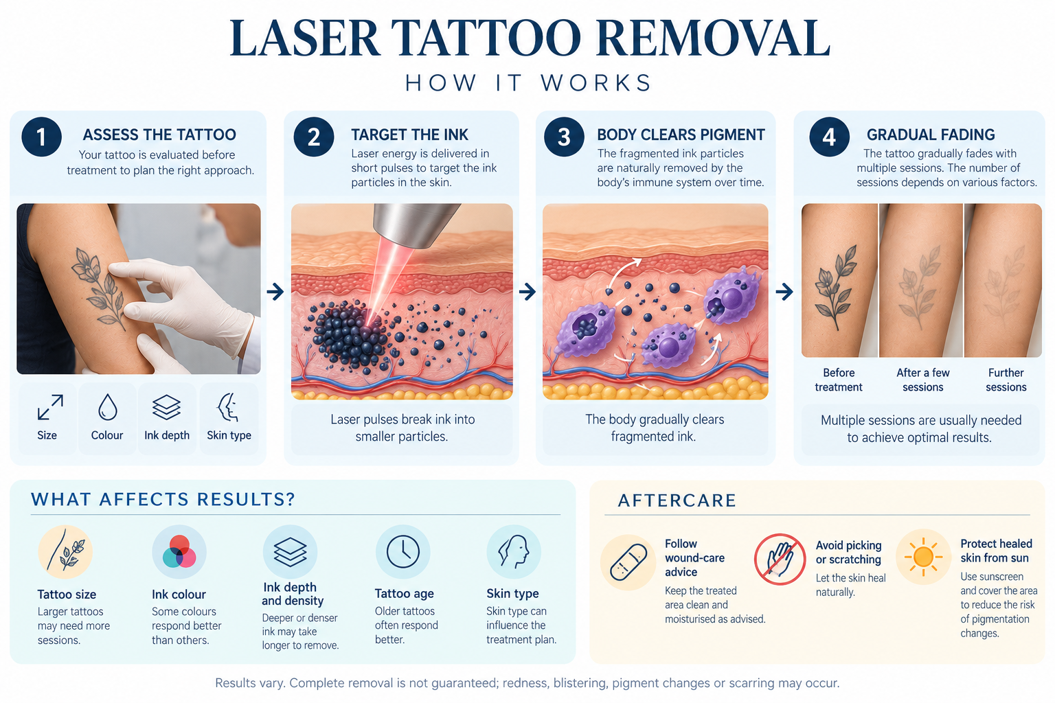 Laser tattoo removal process showing ink fragmentation, gradual fading, and aftercare