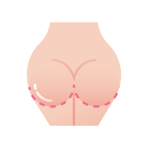Buttock Lift in Mumbai